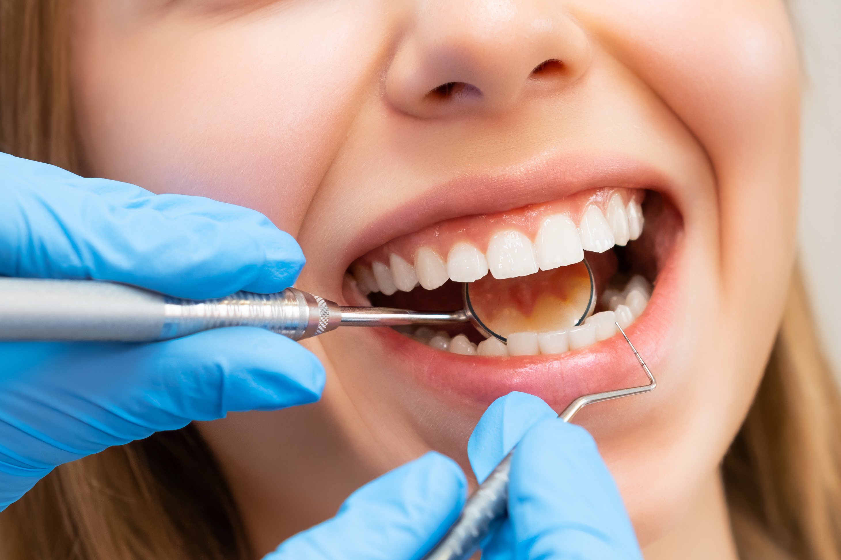 Renton Highlands Dental Emergency: Local Care Guide 2026