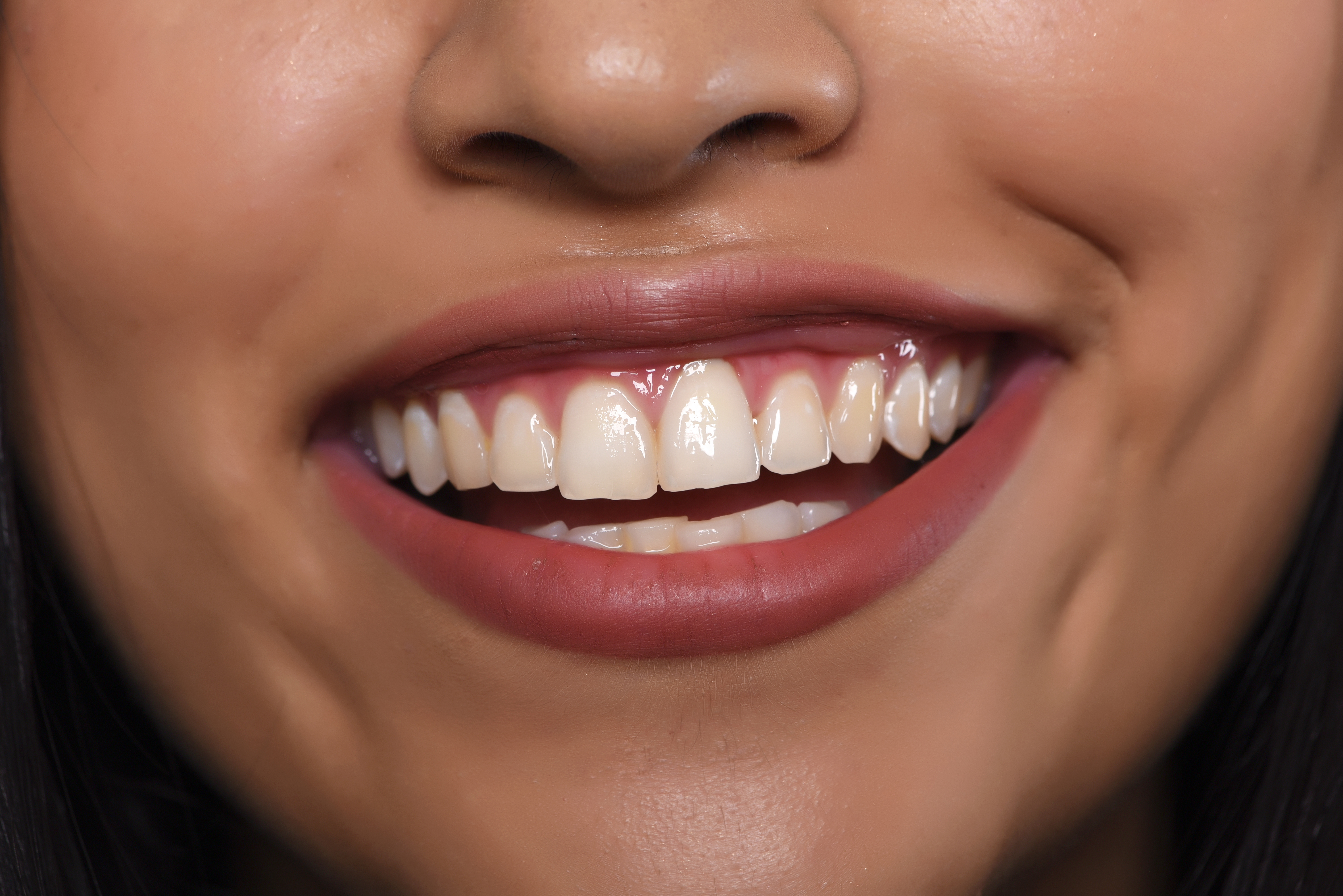 Emergency Dentist in Philadelphia, PA: 2026 Guide
