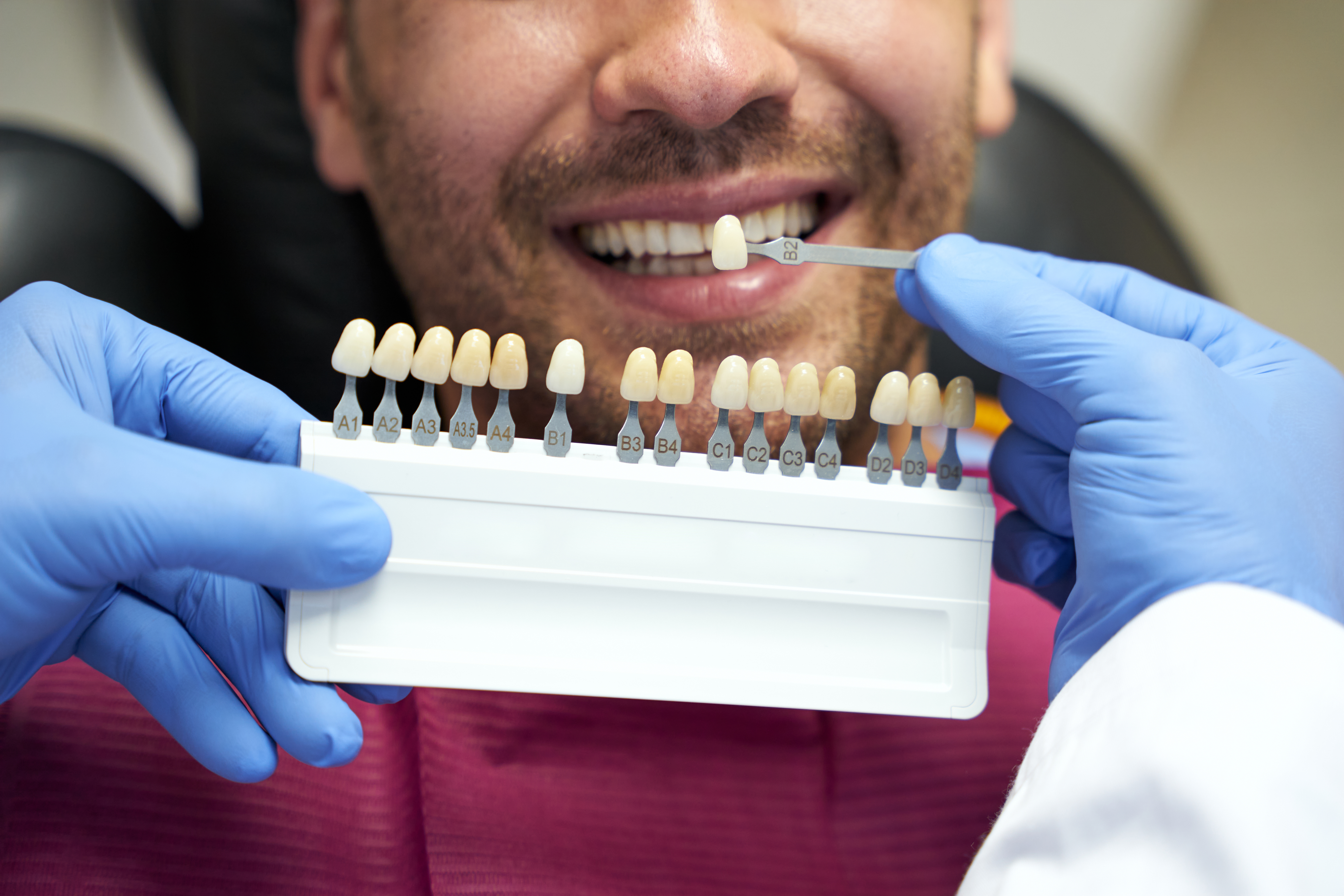 Temporary Tooth Repair Kits vs. Seeing a Dentist in 2026